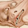 Salvador Dali, Gianni Schicchis Biss, 1964, Original Holzschnitt